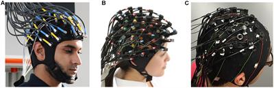 Multi-Modal Integration of EEG-fNIRS for Brain-Computer Interfaces – Current Limitations and Future Directions
